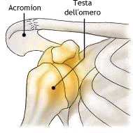 Lussazione sottocoracoidea