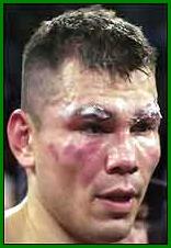 Raul Marquez, whose cuts caused the end of his fight with Shane Mosley
